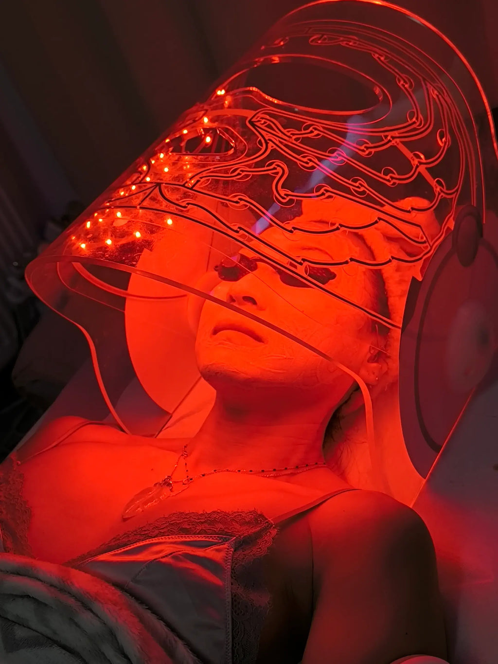 Premium Radiofrequenz Needling Schulung